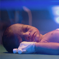 recien nacido en incubadora