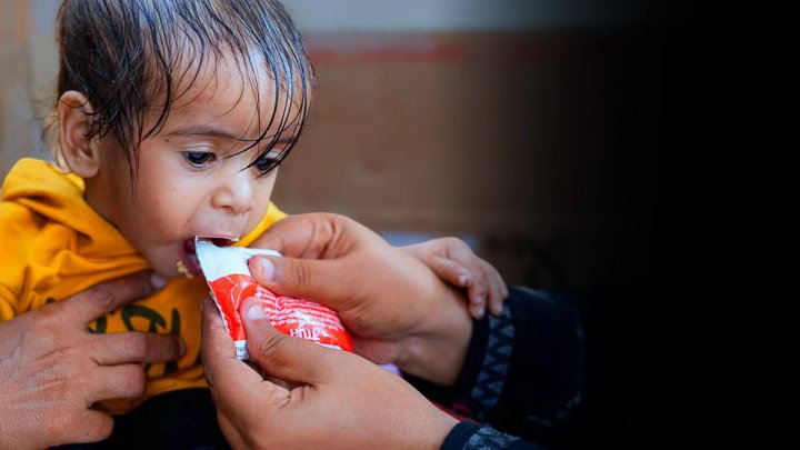 niño en estado de desnutrición comiendo alimento terapeutico mientras es cargado en brazos