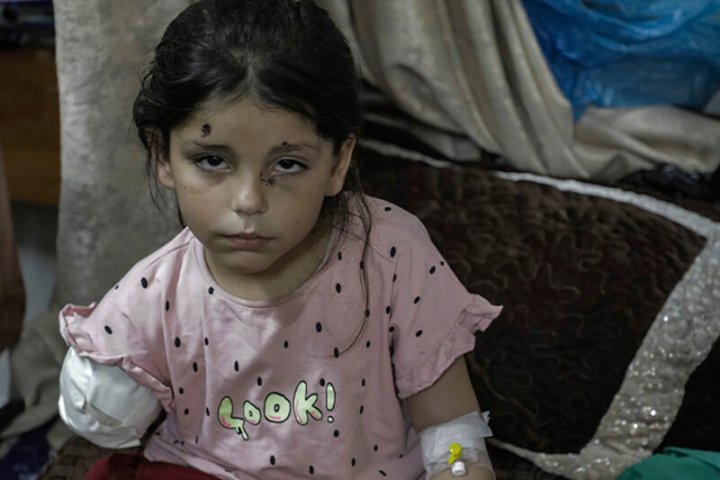 Niña con heridas en Gaza