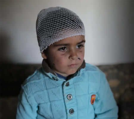 Niño vulnerable en el mundo apoyado por UNICEF — dona aquí para transformar la vida de la infancia más desprotegida